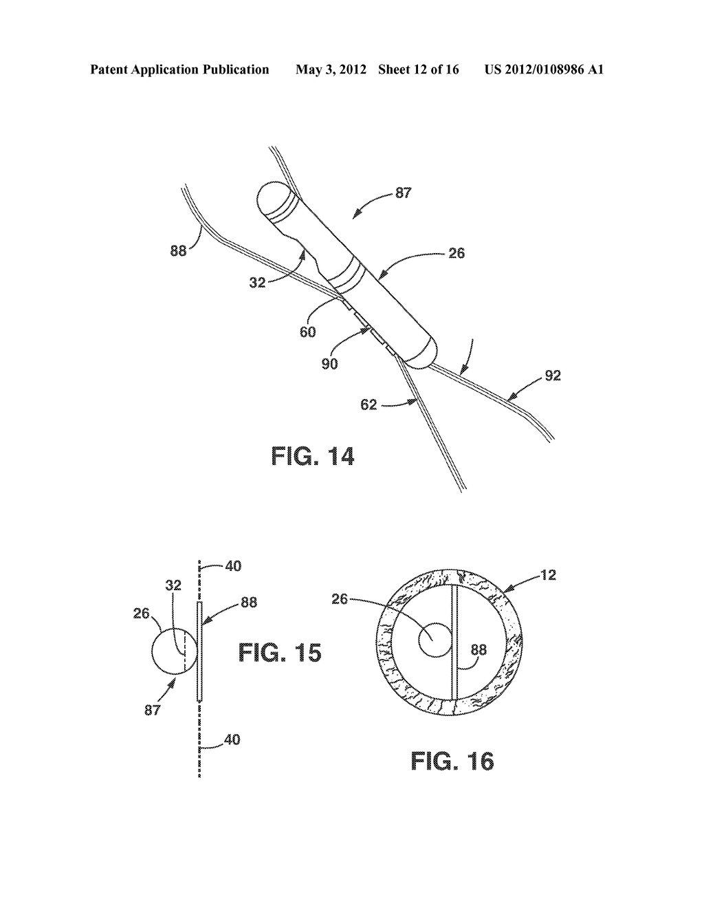 Implantable Medical Sensor and Fixation System - diagram, schematic, and image 13