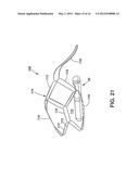 Implantable Medical Sensor and Fixation System diagram and image