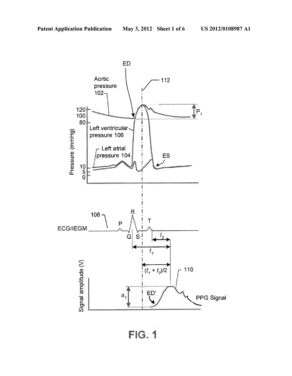 IMPLANTABLE SYSTEMIC BLOOD PRESSURE MEASUREMENT SYSTEMS AND METHODS - diagram, schematic, and image 02