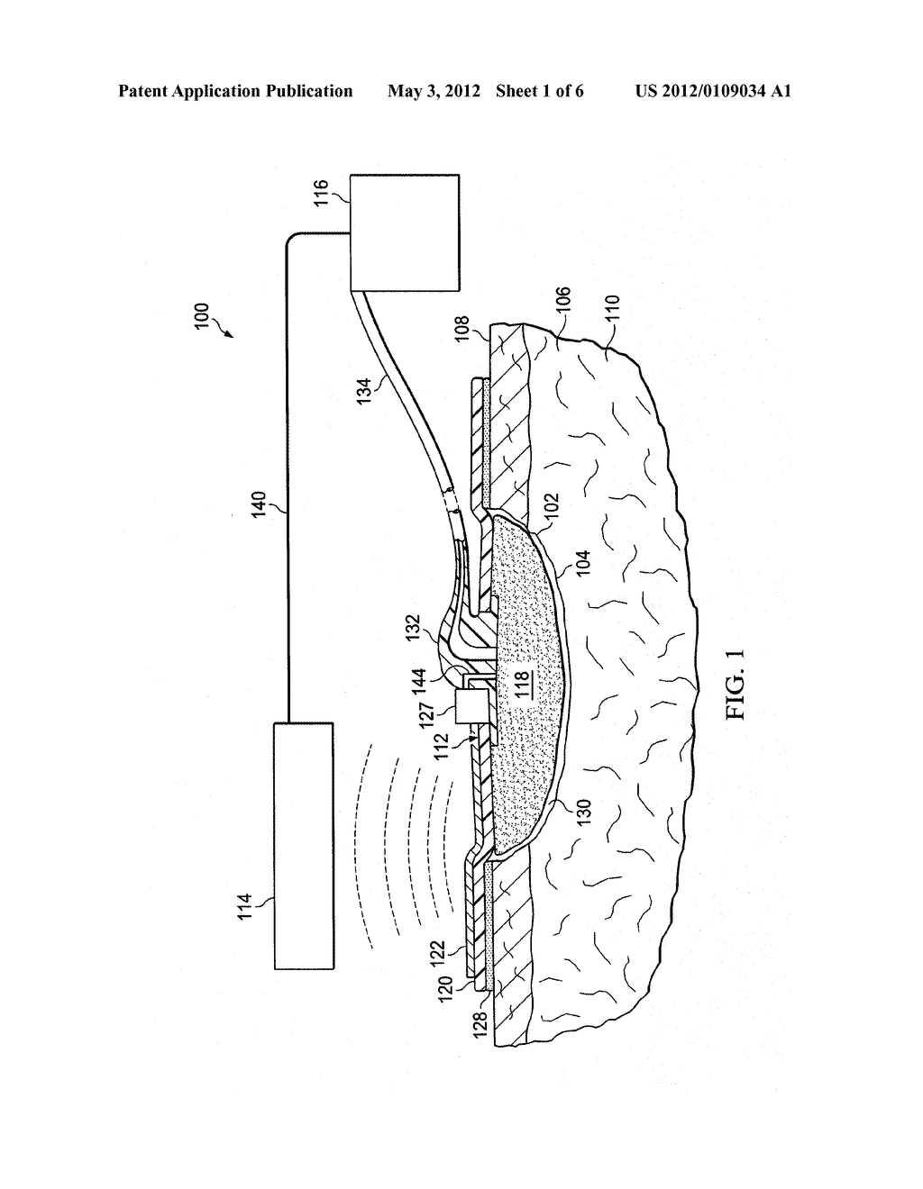 INTERACTIVE, WIRELESS REDUCED-PRESSURE DRESSINGS, METHODS, AND SYSTEMS - diagram, schematic, and image 02