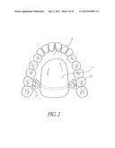 DEVICES, METHODS, AND KITS FOR TASTE MODIFICATION AND CONTROLLING FOOD     INTAKE diagram and image