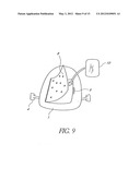 DEVICES, METHODS, AND KITS FOR TASTE MODIFICATION AND CONTROLLING FOOD     INTAKE diagram and image