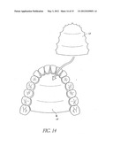 DEVICES, METHODS, AND KITS FOR TASTE MODIFICATION AND CONTROLLING FOOD     INTAKE diagram and image