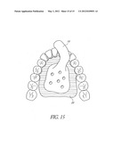 DEVICES, METHODS, AND KITS FOR TASTE MODIFICATION AND CONTROLLING FOOD     INTAKE diagram and image