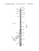 APPARATUS AND METHODS FOR TREATING OBSTRUCTIONS WITHIN BODY LUMENS diagram and image