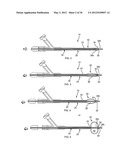 APPARATUS AND METHODS FOR TREATING OBSTRUCTIONS WITHIN BODY LUMENS diagram and image