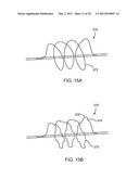 APPARATUS AND METHODS FOR TREATING OBSTRUCTIONS WITHIN BODY LUMENS diagram and image