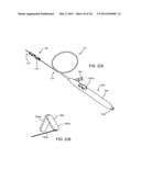 APPARATUS AND METHODS FOR TREATING OBSTRUCTIONS WITHIN BODY LUMENS diagram and image