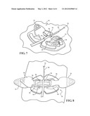 SPECIALIZED CATHETER SECUREMENT DEVICES FOR PERIPHERALLY INSERTED CENTRAL     CATHETERS diagram and image