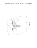 CATHETER SECUREMENT DEVICE TO SECURE SILICONE WINGED PICCS diagram and image