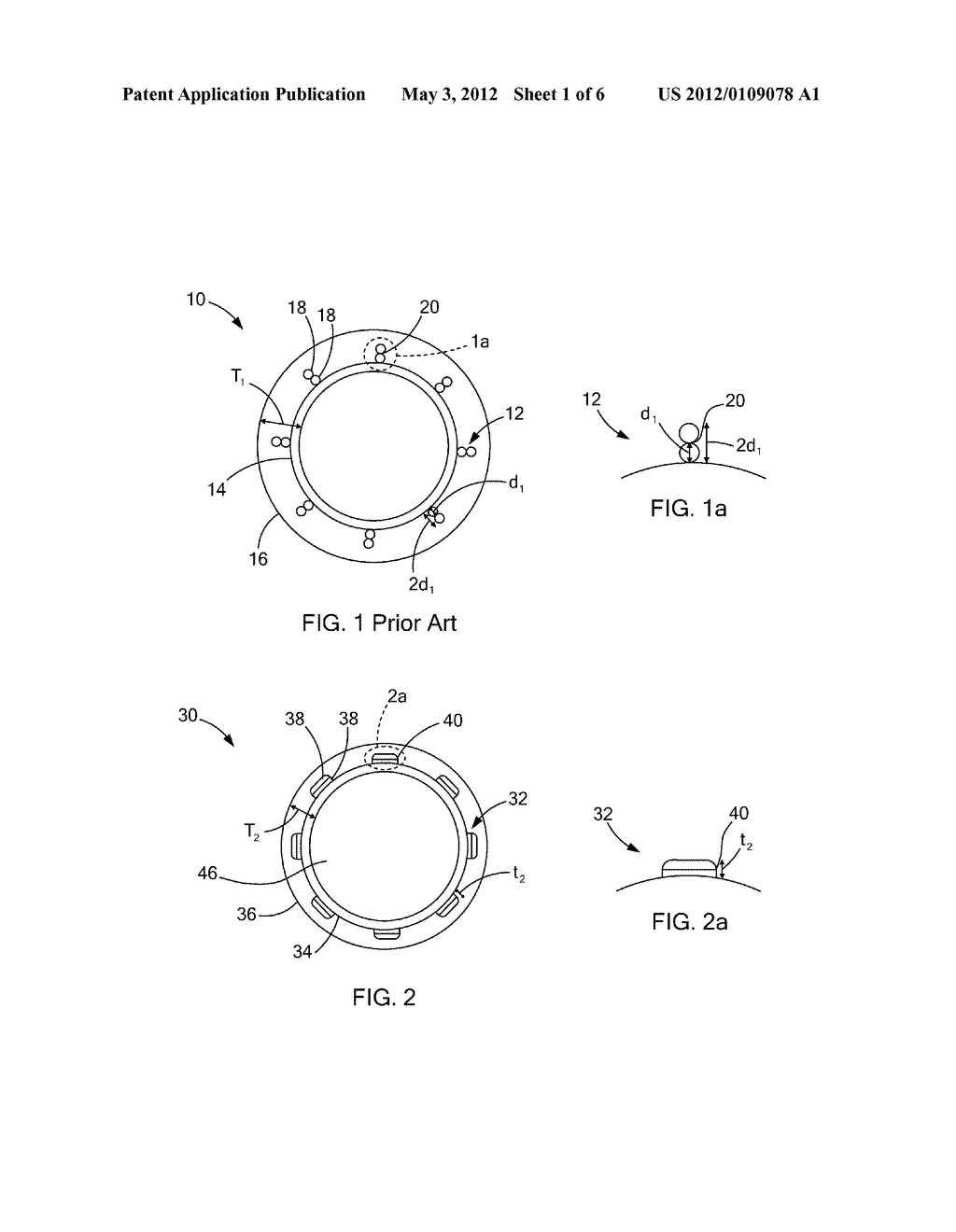 SWAGED BRAIDED CATHETER AND METHOD OF FABRICATION - diagram, schematic, and image 02