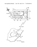 Operating A Portable Medical Device diagram and image