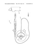 REACTANCE CHANGES TO IDENTIFY AND EVALUATE CRYO ABLATION LESIONS diagram and image