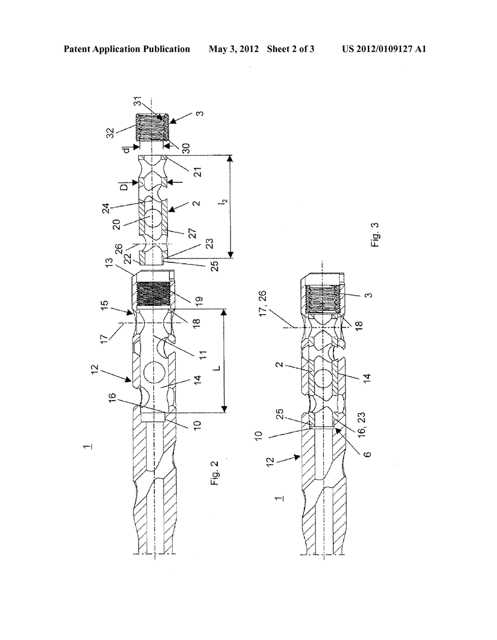 Intramedullary Nail - diagram, schematic, and image 03