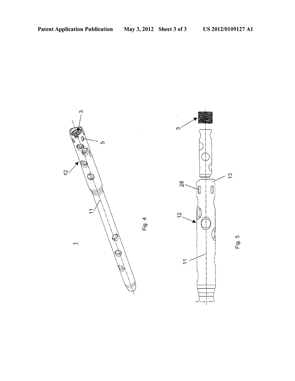 Intramedullary Nail - diagram, schematic, and image 04