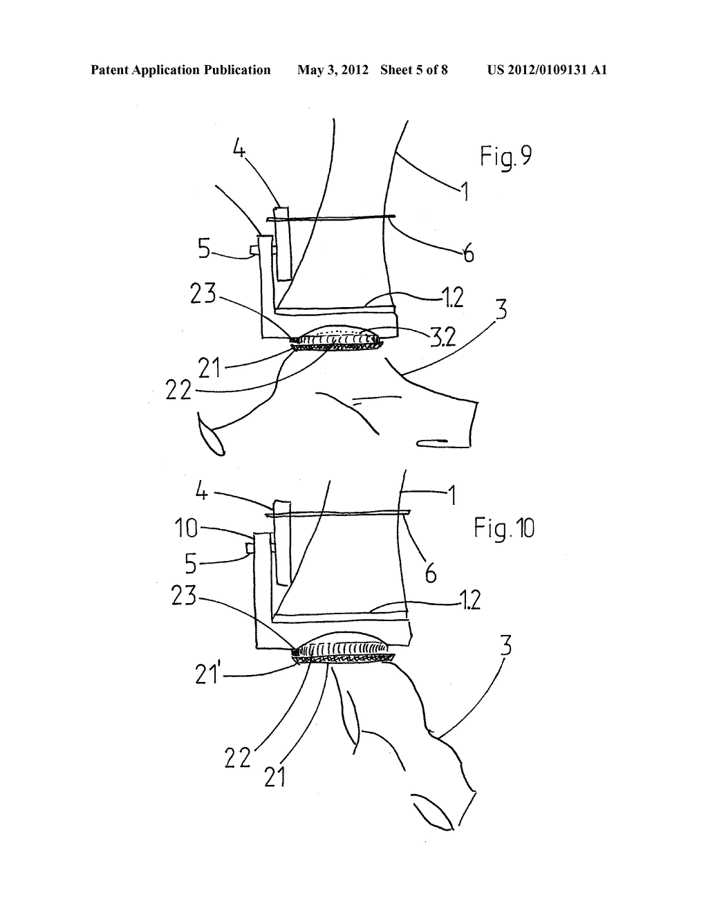 DEVICE FOR IN SITU MILLING OF JOINT SURFACES - diagram, schematic, and image 06