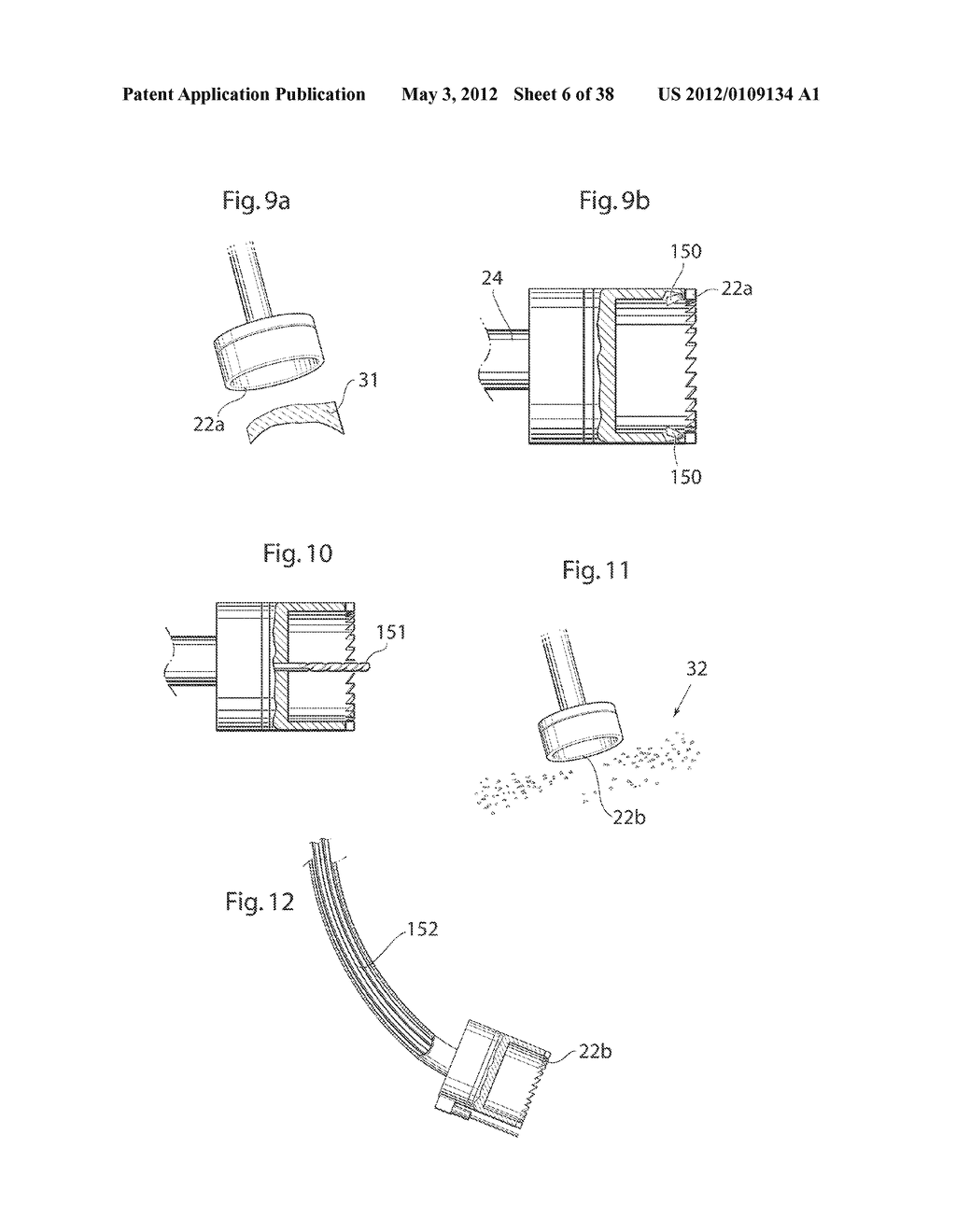 HIP JOINT INSTRUMENT AND METHOD - diagram, schematic, and image 07