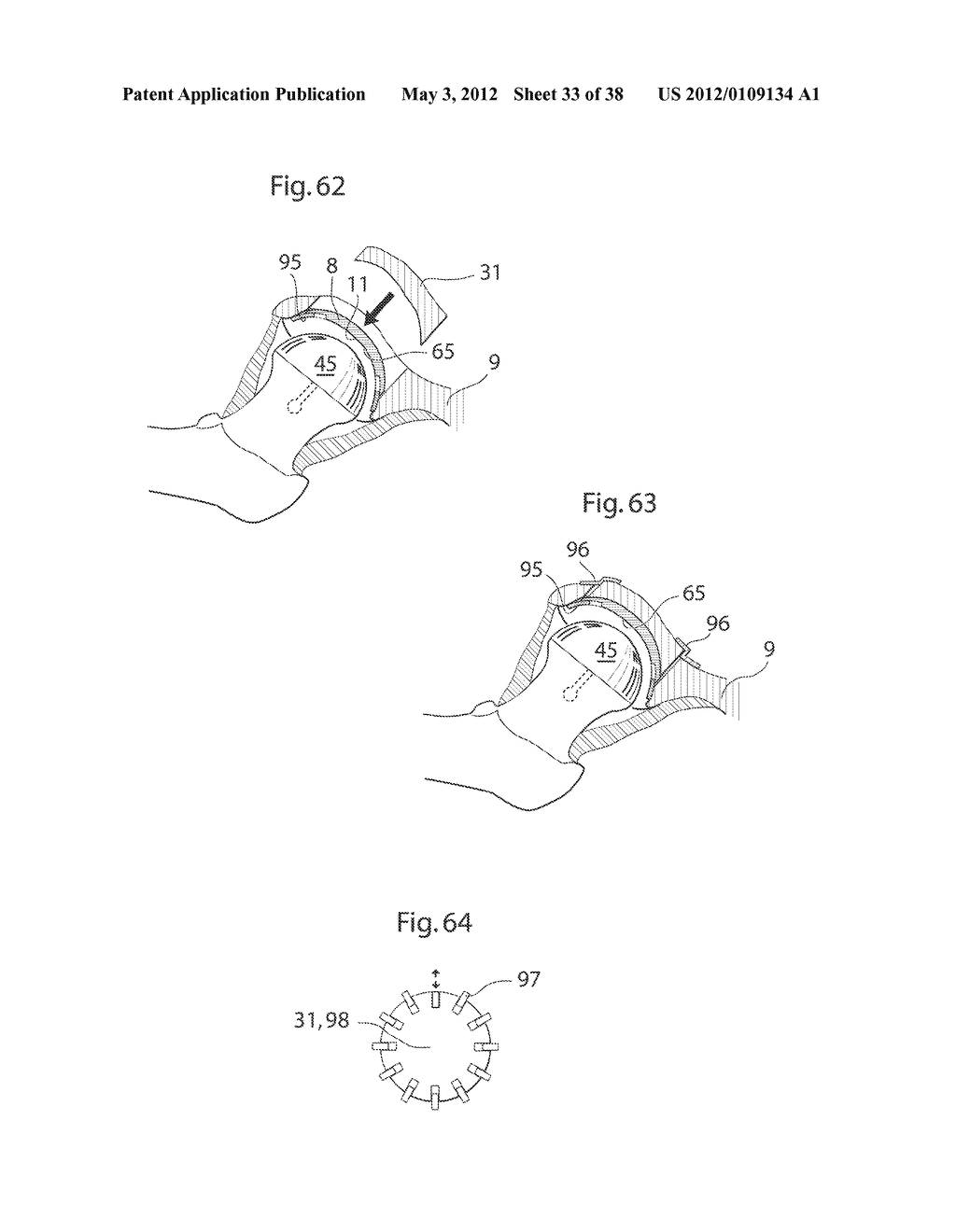 HIP JOINT INSTRUMENT AND METHOD - diagram, schematic, and image 34