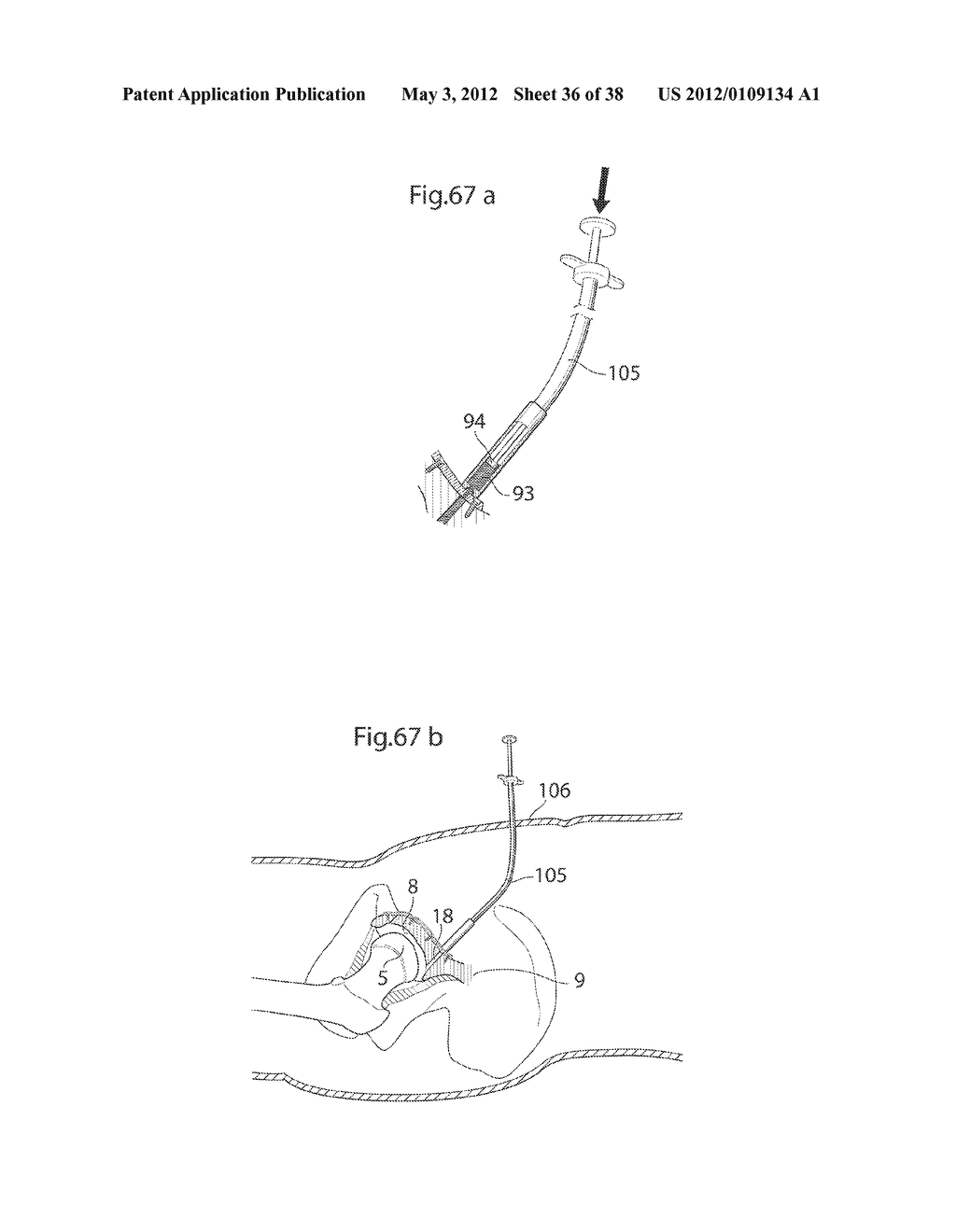 HIP JOINT INSTRUMENT AND METHOD - diagram, schematic, and image 37