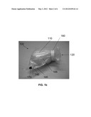 Systems and Methods for Tissue or Organ Removal diagram and image