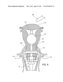 Uterine Manipulators and Related Components and Methods diagram and image