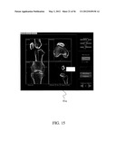 HAPTIC GUIDANCE SYSTEM AND METHOD diagram and image