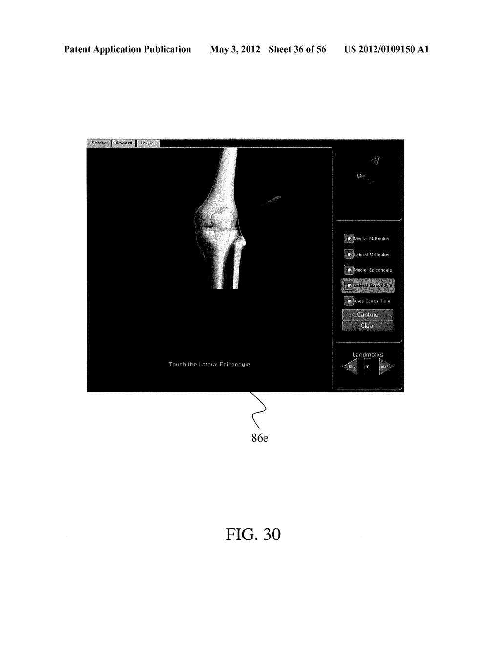 HAPTIC GUIDANCE SYSTEM AND METHOD - diagram, schematic, and image 37