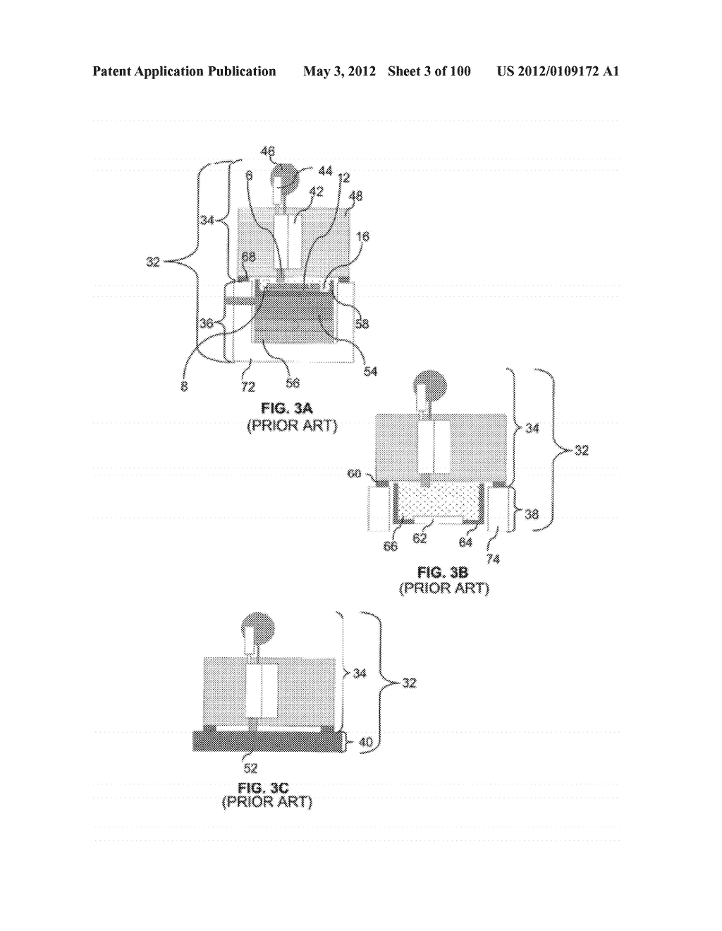 SELECTIVE TISSUE REMOVAL TOOL FOR USE IN MEDICAL APPLICATIONS AND METHODS     FOR MAKING AND USING - diagram, schematic, and image 04