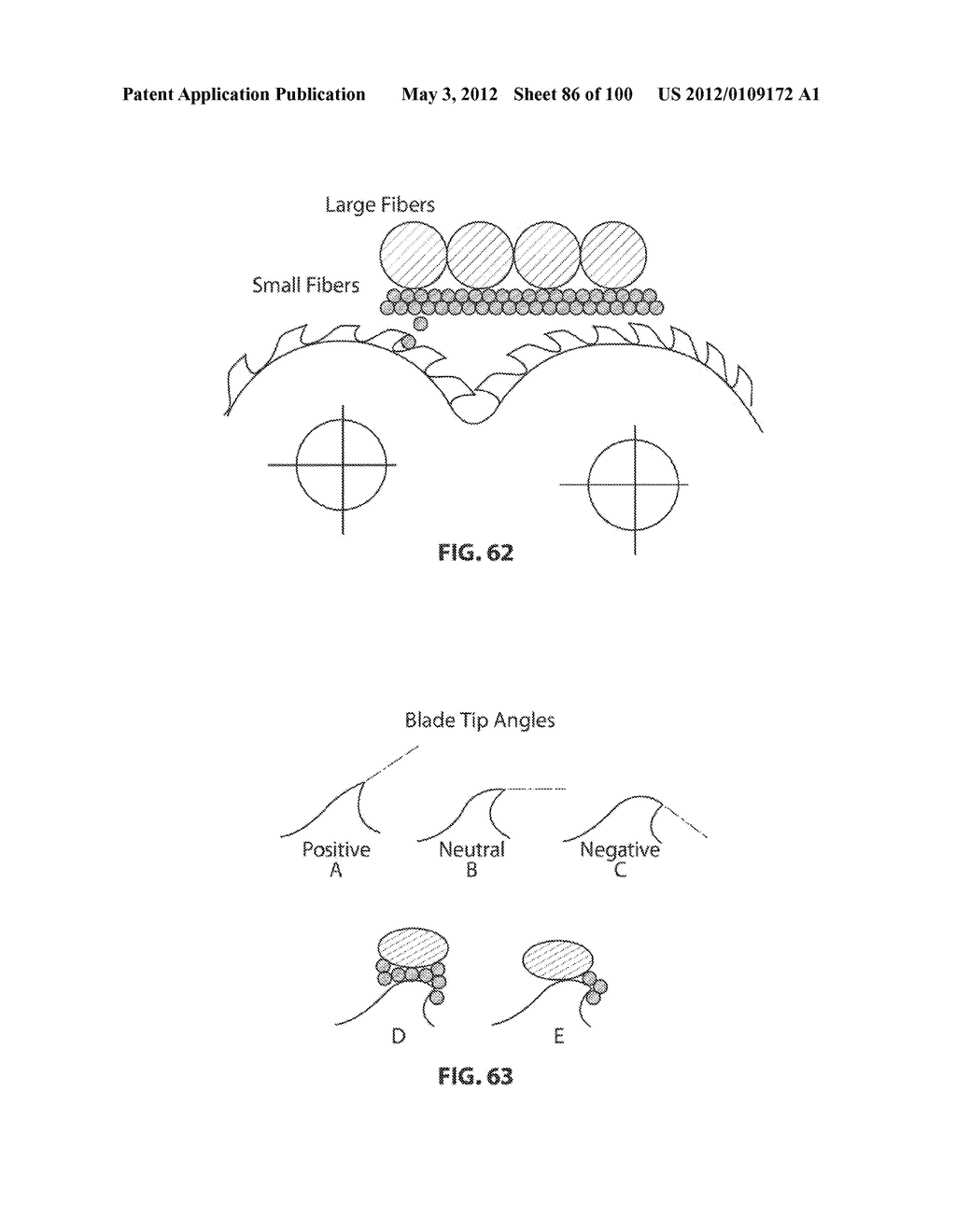 SELECTIVE TISSUE REMOVAL TOOL FOR USE IN MEDICAL APPLICATIONS AND METHODS     FOR MAKING AND USING - diagram, schematic, and image 87