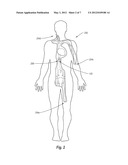 BODY LUMEN FILTER RETRIEVAL SYSTEM AND METHODS FOR FILTERING A BODY LUMEN diagram and image