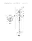 BODY LUMEN FILTER RETRIEVAL SYSTEM AND METHODS FOR FILTERING A BODY LUMEN diagram and image