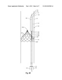 BODY LUMEN FILTER RETRIEVAL SYSTEM AND METHODS FOR FILTERING A BODY LUMEN diagram and image