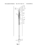 BODY LUMEN FILTER RETRIEVAL SYSTEM AND METHODS FOR FILTERING A BODY LUMEN diagram and image