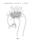 EMBOLIC PROTECTION DEVICE diagram and image