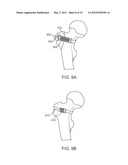 MODULATED CONSTRAINING APPARATUS AND METHODS OF USE diagram and image