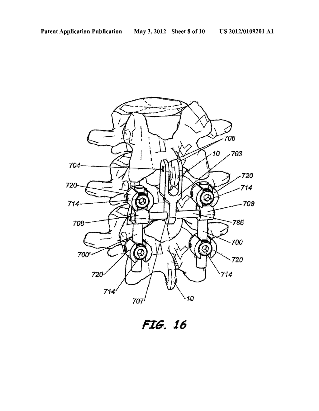 INTERSEGMENTAL MOTION PRESERVATION SYSTEM FOR USE IN THE SPINE AND METHODS     FOR USE THEREOF - diagram, schematic, and image 09