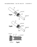 DYNAMIC BONE FIXATION ELEMENT AND METHOD OF USING THE SAME diagram and image