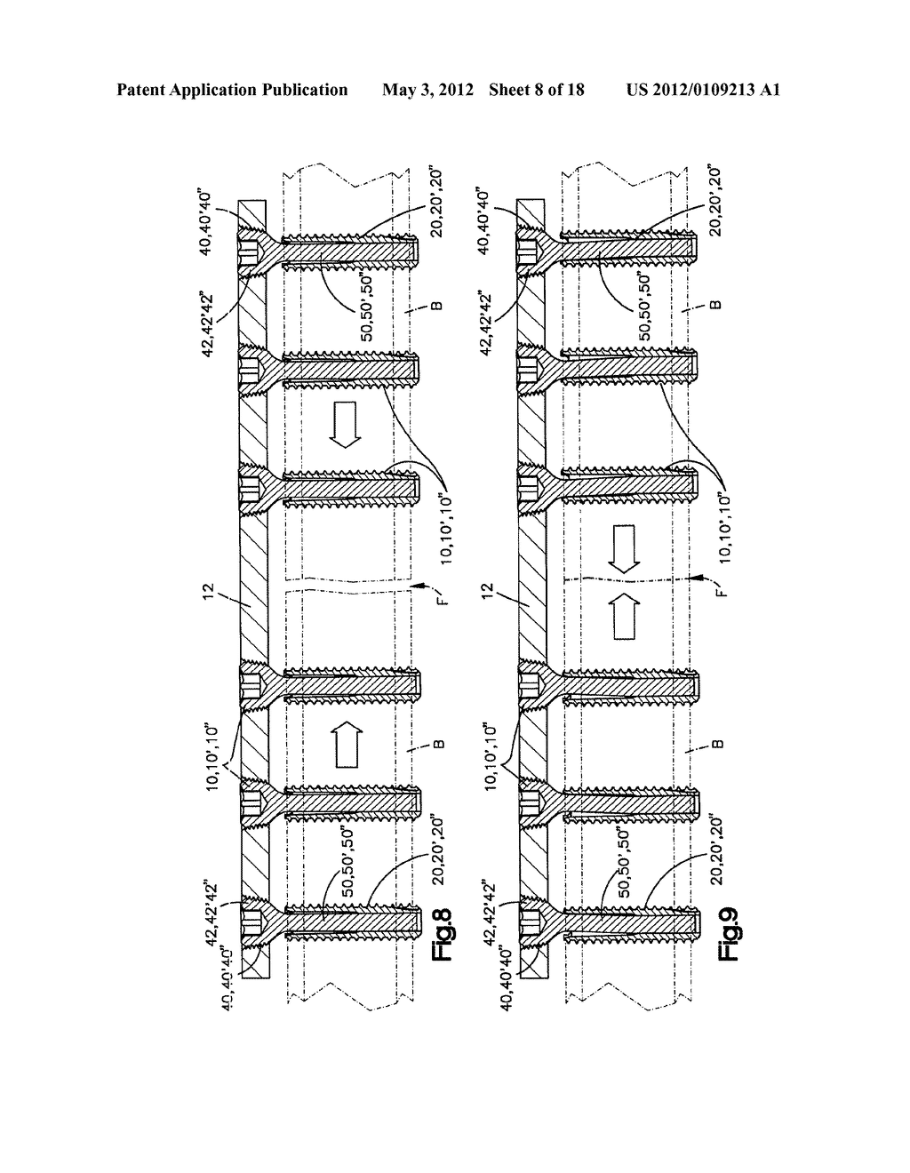 DYNAMIC BONE FIXATION ELEMENT AND METHOD OF USING THE SAME - diagram, schematic, and image 09