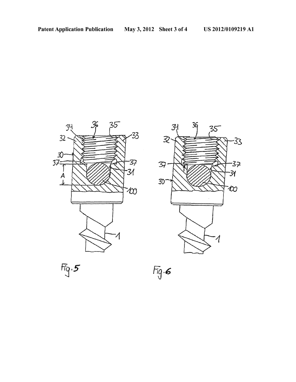 IMPLANT HAVING A SHAFT AND A HOLDING ELEMENT CONNECTED THEREWITH FOR     CONNECTING WITH A ROD - diagram, schematic, and image 04