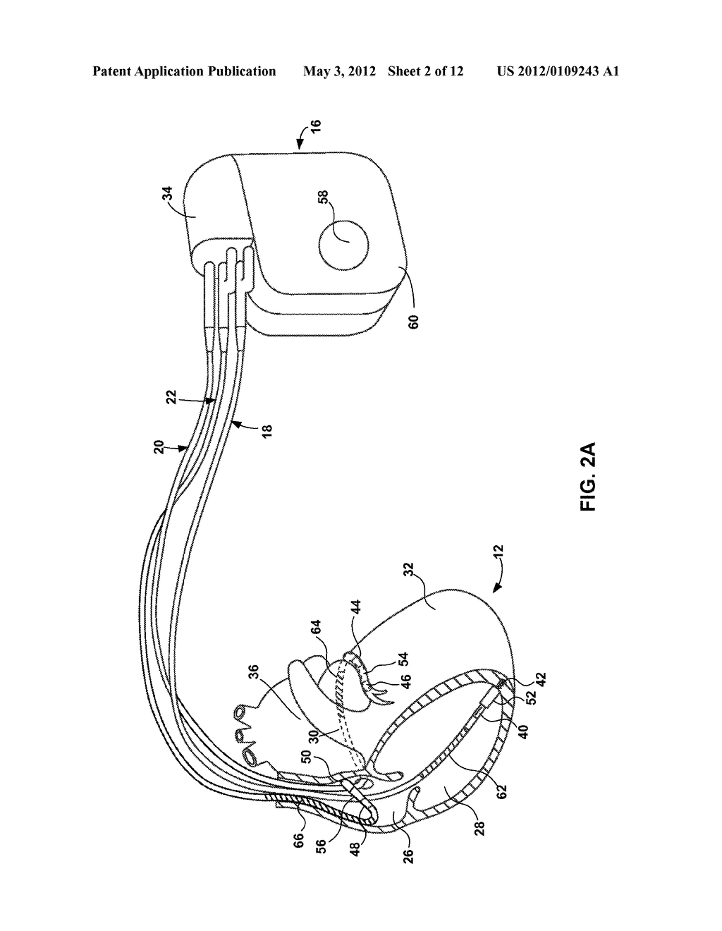 HEART FAILURE MONITORING AND NOTIFICATION - diagram, schematic, and image 03