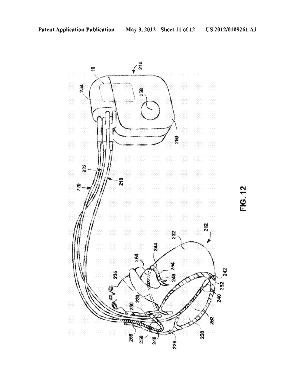 PROTECTING AN IMPLANTABLE MEDICAL DEVICE FROM EFFECTS CAUSED BY AN     INTERFERING RADIATION FIELD - diagram, schematic, and image 12