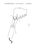 Fungal Infection Therapy Device with Low Level Laser diagram and image