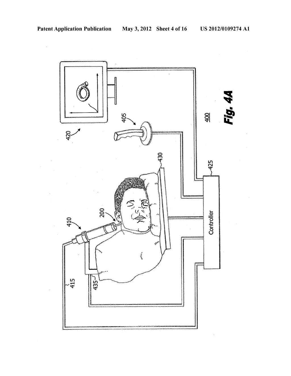 ELECTRODE ARRAYS AND SYSTEMS FOR INSERTING SAME - diagram, schematic, and image 05