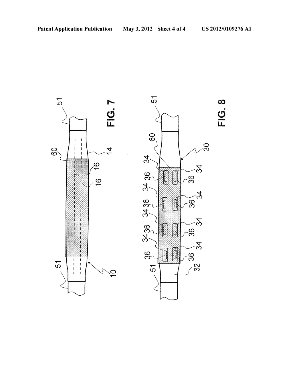 CATHETER, SYSTEM FOR APPLYING AN INTRALUMINAL ENDOPROSTHESIS AND METHOD     FOR PRODUCING SAME - diagram, schematic, and image 05