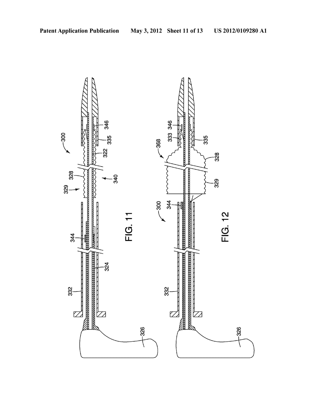 Torsion Constrained Stent Delivery System - diagram, schematic, and image 12