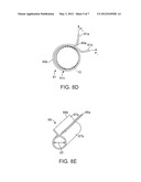 Sheaths Used in Polymer Scaffold Delivery Systems diagram and image