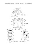 Sheaths Used in Polymer Scaffold Delivery Systems diagram and image