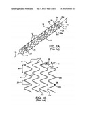 STENT HAVING ADJACENT ELEMENTS CONNECTED BY FLEXIBLE WEBS diagram and image