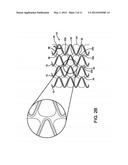 STENT HAVING ADJACENT ELEMENTS CONNECTED BY FLEXIBLE WEBS diagram and image