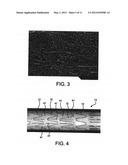 STENT HAVING ADJACENT ELEMENTS CONNECTED BY FLEXIBLE WEBS diagram and image